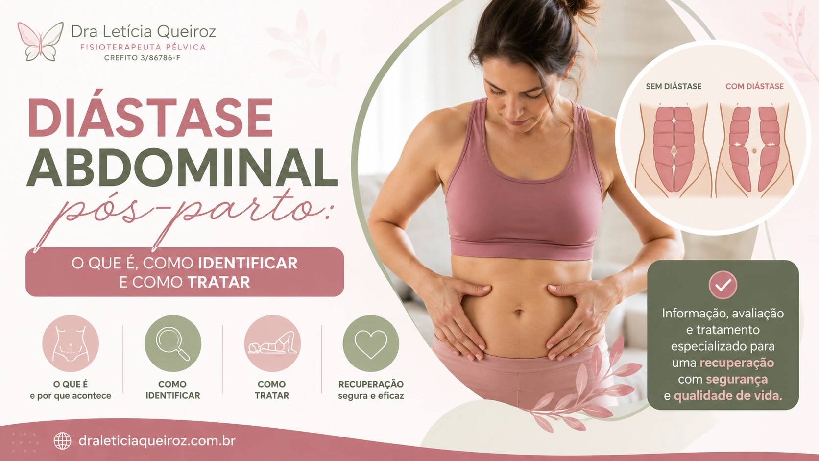 Diástase abdominal pós-parto: o que é, como identificar e como tratar